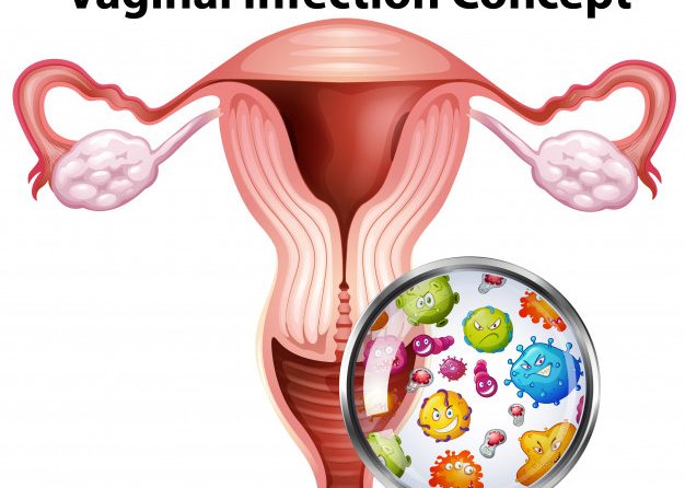 الحكة المهبلية ….الأسباب والتشخيص والوقاية والعلاج