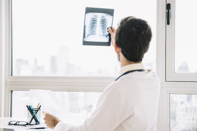 WHO ARE AT RISK OF LUNG CANCER?