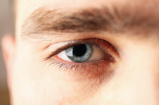 ترهل الجلد حول العينين، ما هي أسبابه وطرق علاجه؟