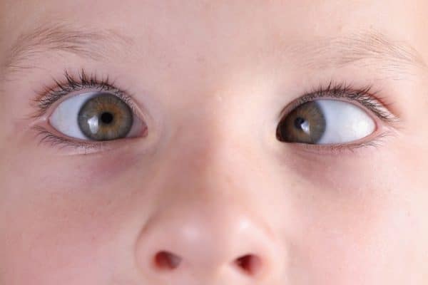 Strabismus in children. What are its types and treatment methods?